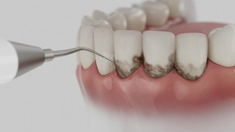 Reliable Dental contractor in Frankfort, IN by Dentist Open Now